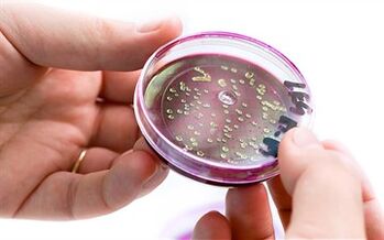 Bakteret në sekretimin e prostatës